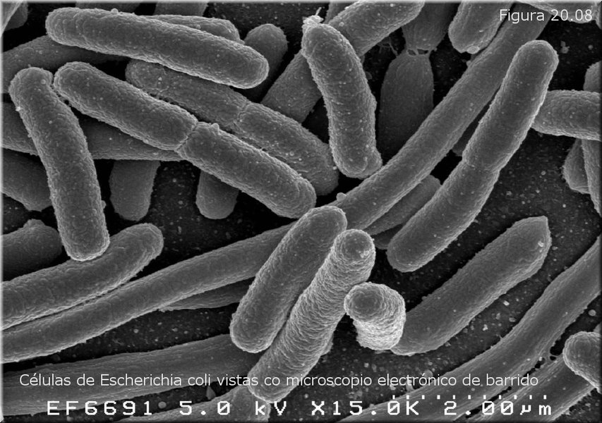 Células de Escherichia coli